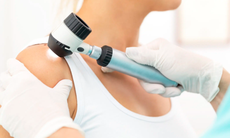 Protecting Your Skin Through Early Detection