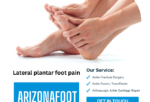Lateral Plantar Foot Pain: Causes, Symptoms, and Treatment Options