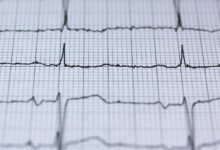 apex orbit growth pulse